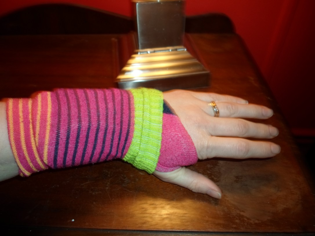 I have conservative socks I can wear, but I usually prefer the Pippi Longstocking look while wearing my braces.